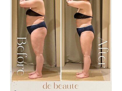 ドゥ ボーテ(de beaute)の写真