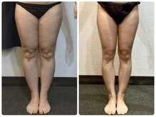 美容整体ウェリナ 中川八田院/小顔矯正/骨盤矯正/痩身整体