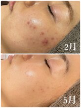 リノベル(LINOBELLE)/継続は確実に！！