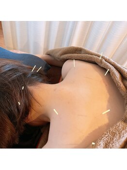 ねむのき鍼灸整骨院/