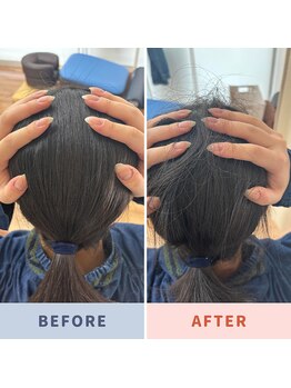 市川本八幡リーフ整骨院/ビフォーアフター/ヘッドスパ