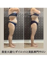 ミノ 美里大通り店(mino)/ダイエットパッケージ