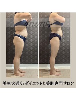 ミノ 美里大通り店(mino)/ダイエットパッケージ