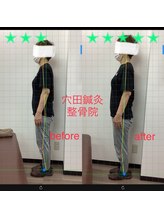 穴田鍼灸整骨院/整体・骨盤・ねこぜ・まき肩矯正