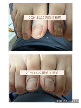 ブロックファイブハナ(Block 5 HANA)/