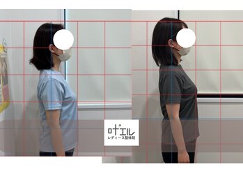 叶'エル 本町 心斎橋院/姿勢改善　肩甲骨矯正