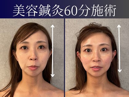 シンク(CINQ)の写真