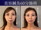 シンク(CINQ)の写真