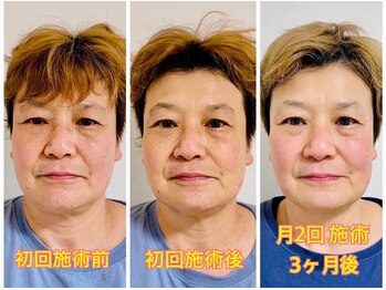 ダイエット×オーダーメイド整体/◎幹細胞で劇的くすみ改善◎