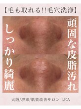 レア(Lea)/頑固な皮脂.毛穴汚れを除去＊