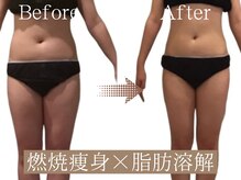 ティパニボーテ(Tipani Beaute')