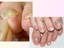 ポポネイル(POPO nail)