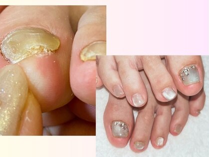 ポポネイル(POPO nail)の写真