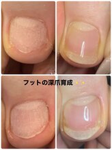 モアニヒロオ 広尾駅前店(MOANI Hiroo)/【トラブルフット】改善＾＾