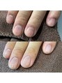 ダリアビューティー(Dahlia Beauty) 男女問わずお手元のケアお任せください^^