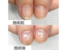 大人ネイル/通うたびに爪の形が美爪に変化☆