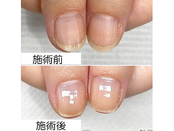 通うたびに爪の形が美爪に変化☆