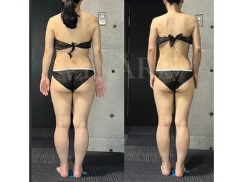 ヴィナーレ(VINARE)/40代のお客様