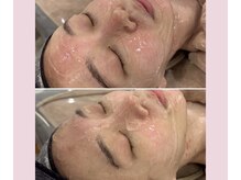 ジェニー(JENNI)/LDM水玉リフティング