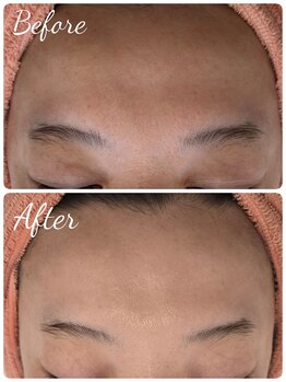 サロンド シェリー(Salon de Cherie)/ララピール×高密度超音波