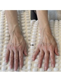 ケアとハンドエステでこんな違う