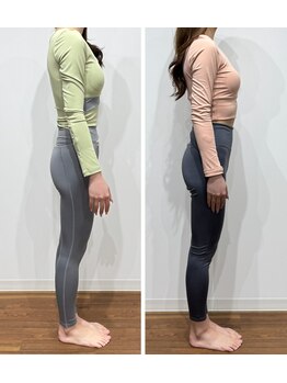 レナセール FUK 福岡店(RENACER FUK)/姿勢の調整