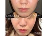 お得【脂肪撃退フェイシャル】脂肪撃退美容液3ml +フォースフェイス／9500円