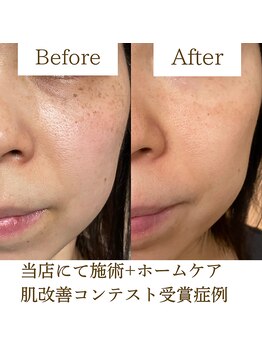 キレイノココロミ(きれいのCoCoRomi)/