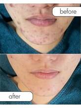 リノルーア(Linolua)/触れたくなるようなツヤ肌へ