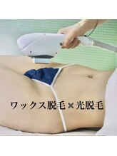 ＷＡＸ脱毛＋光脱毛【MIX脱毛】でシェービング無しでも仕上がりツルツル＆持続性もUP！
