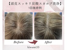 キワミ サーティスリー(kiwami33)/ペタッと頭皮に、ハリつやアップ