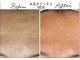 アリュール 倉敷(ALLURE)の写真/最新美肌ケア【今までにない体感と効果をエステでも】1回の導入効果が凄い◎毛穴の開き/赤み/しわ改善に◎
