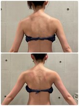 エクセレントビューティーサロン 艶(EN)/ブライダル１回