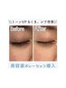 毛穴レス韓国美人に♪【乾燥/ニキビケア】ヒアルロン酸導入（AI肌診断付き）
