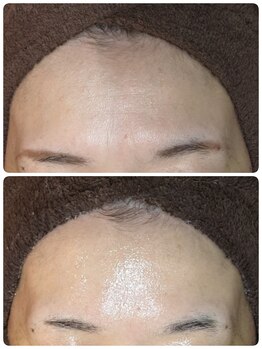 ウララ(ulala)/セルマンビフォアフ