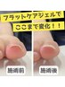 【巻き爪ケアジェル】巻き爪補正2本　¥4000→¥3000(1本¥1500)＋ワンカラー