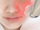 ホノカ(HOnoKA)の写真/EMSの美顔器で表情筋を鍛えてリフトUP+ヒト幹細胞培養上清液導入で年齢に負けない若々しい美肌印象へ！