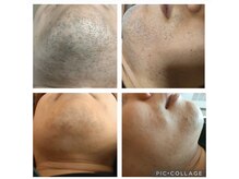 獅子の褒美の雰囲気（メンズ脱毛を種類豊富にご用意！）