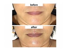 サロン シェリール(Salon Cherir)/小顔調整