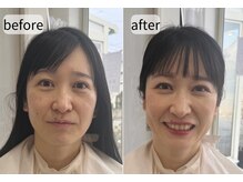 シロイロ(shiroiro)/ビフォーアフター