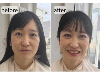 シロイロ(shiroiro)/ビフォーアフター