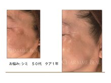 リンクアンドボーテ 大垣(Link&Beaute)/エイジングケア　しみ.キメ