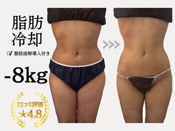 サロン ド パーフェクション(Salon de Perfection)の写真/つらい運動・食事制限なし！360°冷却して排出を促す最新冷却マシン導入！