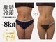 サロン ド パーフェクション(Salon de Perfection)の写真/つらい運動・食事制限なし！360°冷却して排出を促す最新冷却マシン導入！