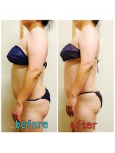 スマイルボディ つぼの森 吉野店(Smile body)/メディセル　　上半身