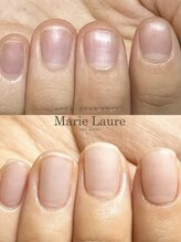 マリーロール 天王寺店(Marie Laure)/自爪育成/深爪矯正/ネイルケア