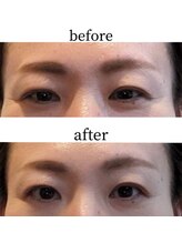 ことりと葉 平尾店/小顔調整＋ドライヘッドスパ