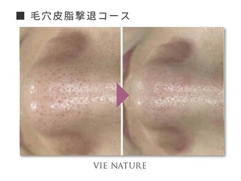 ヴィナチュール(vie nature)/ ■毛穴ケア