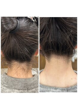 アレーズ(Al'aise)/◇うなじシェービング◇