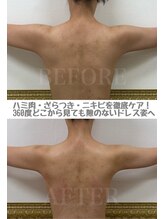 シェミー(CHEZ MEE) 美背中 + 魅せる肌★